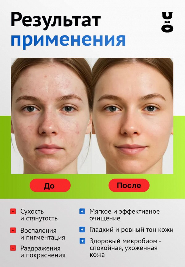 Cha U Kao Набор для ухода за лицом - подарочный - фото 3