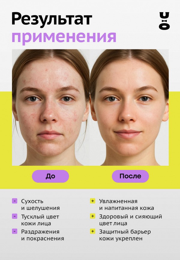 Cha U Kao Крем для лица - ламеллярный увлажняющий - фото 4