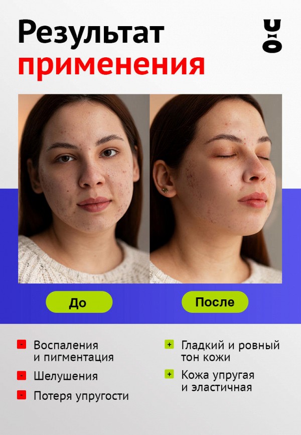 Cha U Kao Тоник для лица - отшелушивающий, с фруктовыми экстрактами - фото 3