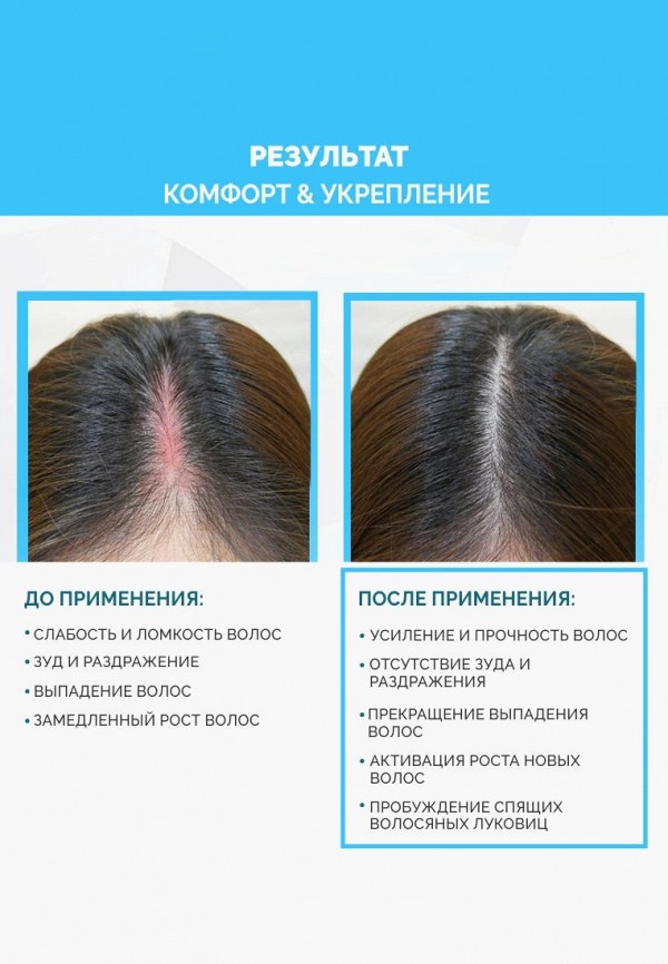 Ринфолтил Лосьон для волос - PRO   от выпадения для чувствительной кожи головы 100 мл - фото 4