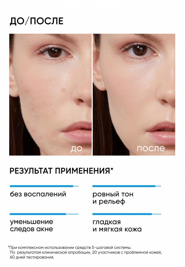 Icon Skin Пилинг для лица - с AHA-BHA кислотами, для жирной и проблемной кожи - фото 2