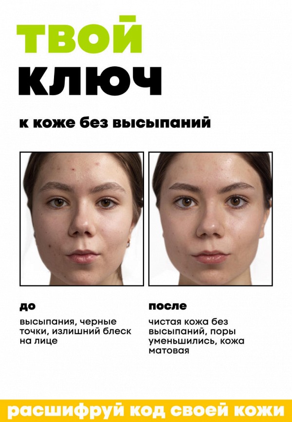 De_code Лосьон для лица - для молодой кожи с салициловой кислотой против прыщей и черных точек, 150 мл - фото 4