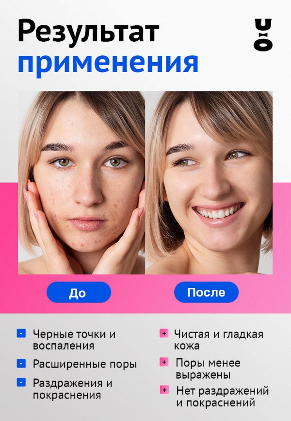 Cha U Kao Пудра энзимная - для борьбы с акне - фото 4