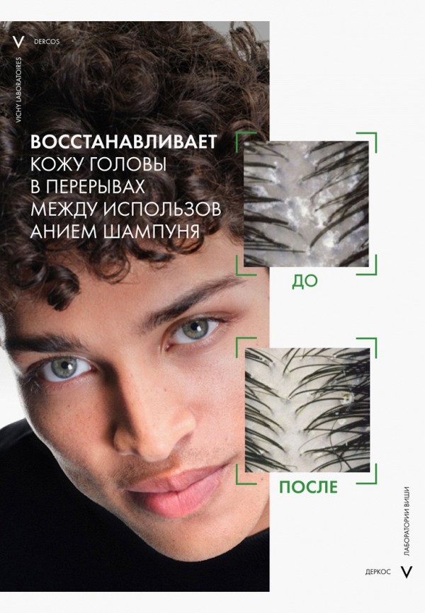 Vichy Сыворотка для волос - против перхоти - фото 5