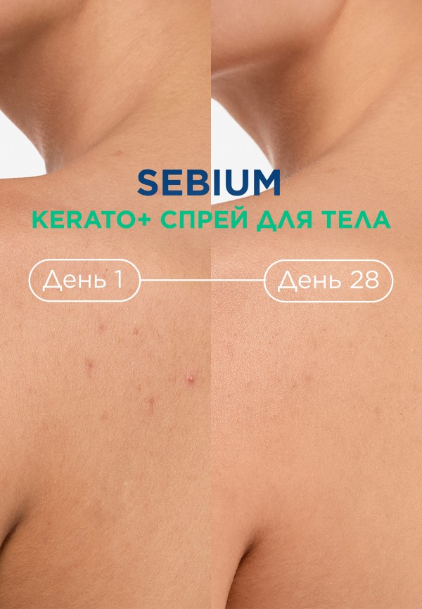 Bioderma Спрей для тела - против несовершенств - фото 6